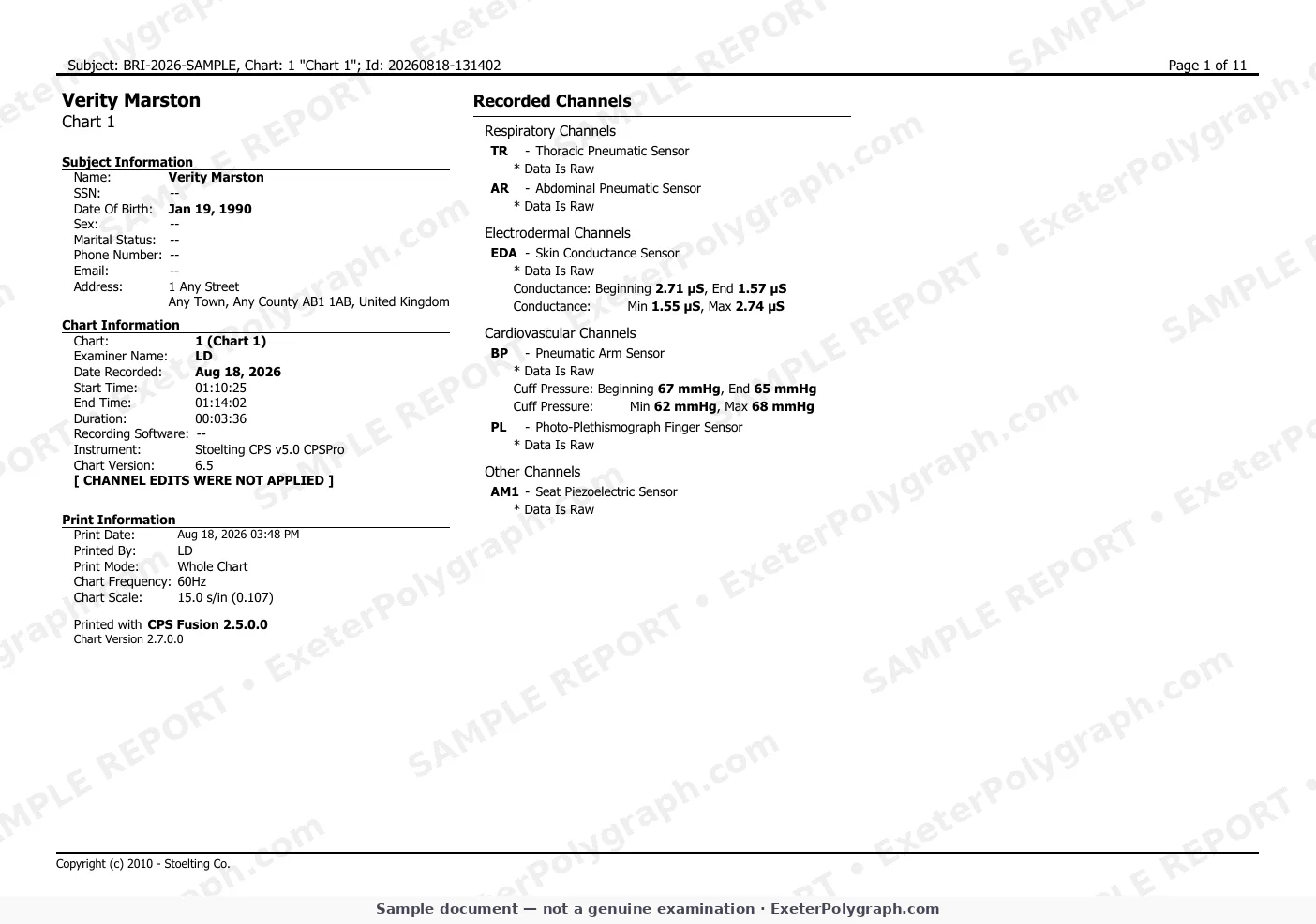 charts page 1 (sample, watermarked)